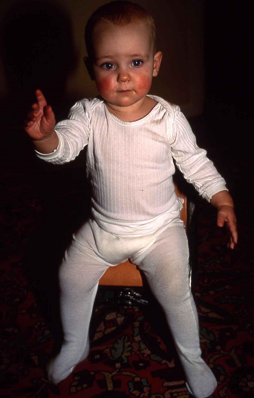 A color photograph of a young light-skinned toddler with red cheeks wearing all white, raising one hand, and looking at the viewer.