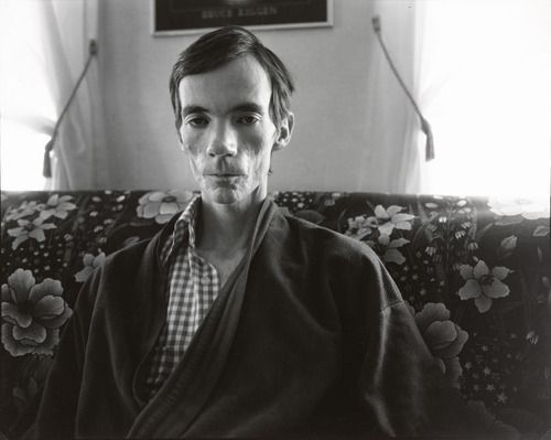 A black-and-white photograph of a very gaunt man sitting upright on a floral couch in a bathrobe.